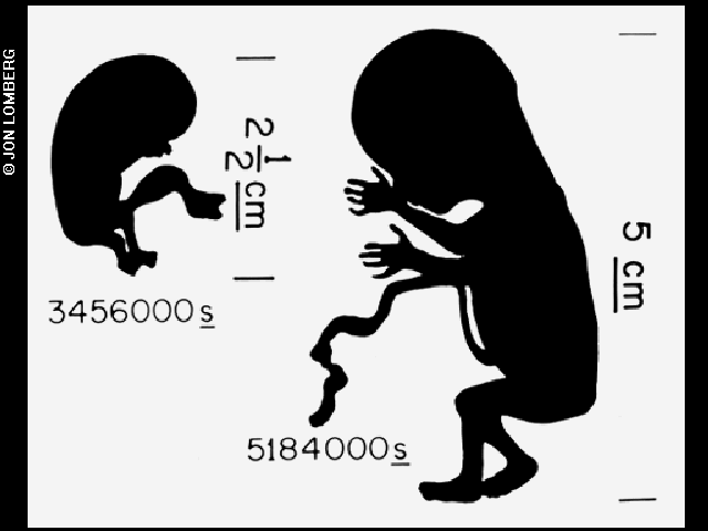 fetus-diagram_30540929914_o.gif