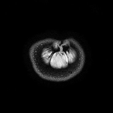 orange-mri.gif