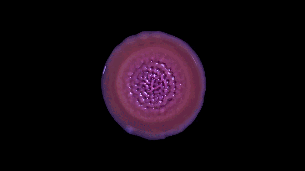 Pseudomonas aeruginosa