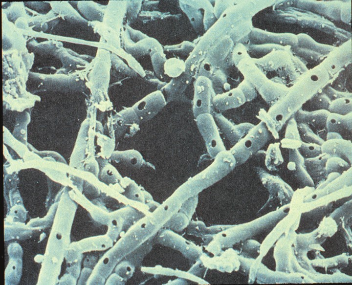 Обнаружены споры и мицелий. Дикариотический мицелий. Мицелий грибов под микроскопом. Ризоктония мицелий. Мицелий грибов микробиология.